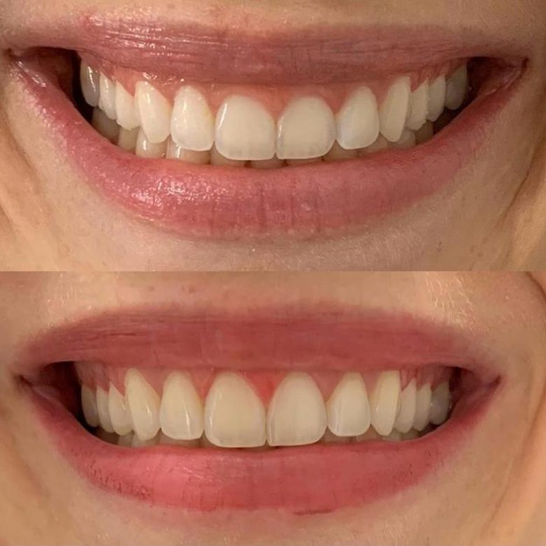 Periodontia 01